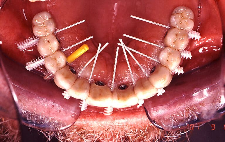 dental eye foto4